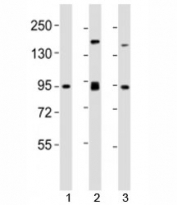 Western blot testing of SUZ12 antibody at 1:2000 dilution. Lane 1: mouse spleen lysate; 2: F9 lysate; 3: HeLa lysate; Observed molecular weight 83~95 kDa.