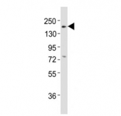 Western blot testing of Erbb3 antibody at 1:2000 dilution + mouse lung lysate; Predicted band size : 148 kDa.