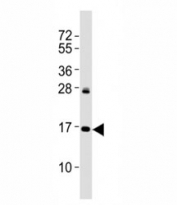 Western blot testing of p16INK4a antibody at 1:2000 dilution + HeLa lysate; Predicted molecular weight: 17 kDa.