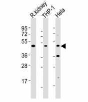Western blot testing of BMP2 antibody at 1:2000 dilution. Lane 1: rat kidney lysate; 2: THP-1 lysate; 3: HeLa lysate; Expected molecular weight: 13-14 kDa per monomer.