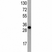 Western blot analysis of APG7 antibody and recombinant protein fragment (34KD).