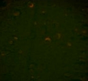 Immunofluorescence analysis of BECN1 antibody with paraffin-embedded human brain tissue; Ab was followed by PE-conjugated goat anti-mouse lgG. PE emits orange fluorescence.