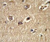 IHC analysis of FFPE human brain with BECN1 antibody