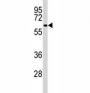 Western blot analysis of BECN1 antibody and Jurkat lysate at 1:100 dilution.