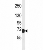 Western blot analysis of NGFR antibody and mouse heart tissue lysate. Predicted molecular weight ~45/75kDa (unmodified/glycosylated).