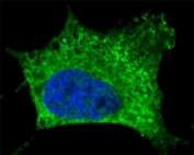 Fluorescent confocal image of SY5Y cells stained with NGFR antibody. Alexa Fluor 488 secondary Ab (green) was used (1:1000, 1h). Nuclei were counterstained with Hoechst 33342 (blue) (10 ug/ml, 5 min).