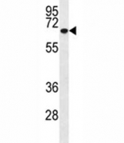 Western blot analysis of MMP2 antibody and T47D lysate (1:200). Expected molecular weight: ~72 kDa (pro form), ~63 kDa (cleaved form).