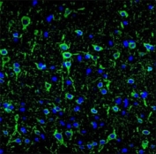 Confocal immunofluorescent analysis of MAP2 antibody with brain tissue followed by Alexa Fluor 488-conjugated goat anti-mouse lgG (green). DAPI was used as a nuclear counterstain (blue).