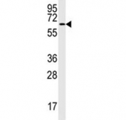 MAP2 antibody western blot analysis in MCF-7 lysate. Ab used at 1:1000 dilution. MAP2 can be observed at ~280 kDa (isoforms A & B) and ~70 kDa (isoform C).