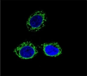 Confocal immunofluorescent analysis of Nephrin antibody with HeLa cells followed by Alexa Fluor 488-conjugated goat anti-mouse lgG (green). DAPI was used as a nuclear counterstain (blue).
