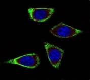 Confocal immunofluorescent analysis of c-RET antibody with MDA-MB231 cells followed by Alexa Fluor 488-conjugated goat anti-mouse lgG (green). Actin filaments have been labeled with Alexa Fluor 555 Phalloidin (red). DAPI was used as a nuclear counterstain (blue).