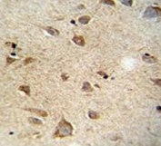 c-RET antibody immunohistochemistry analysis in formalin fixed and paraffin embedded human brain tissue.