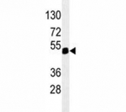 PAX6 antibody western blot analysis in 293 lysate. Predicted molecular weight ~48kDa.