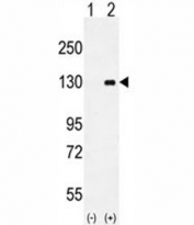 Western blot analysis of CSF1R antibody and 293 cell lysate (2 ug/lane) either nontransfected (Lane 1) or transiently transfected (2) with the CSF1R gene.