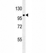 ZEB1 antibody western blot analysis in A549 lysate. Predicted molecular weight ~124 kDa but observed at up to ~200 kDa.