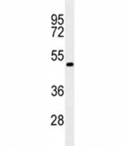 RNF8 antibody western blot analysis in K562 lysate. Predicted molecular weight ~56 kDa but may be observed at larger sizes due to ubiquitination.