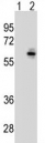 Western blot analysis of CDC25C antibody and 293 cell lysate (2 ug/lane) either nontransfected (Lane 1) or transiently transfected (2) with the CDC25C gene. Expected molecular weight: ~53/60 kDa (unmodified/phosphorylated).