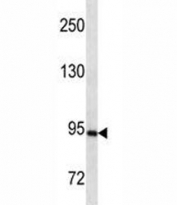 PR antibody western blot analysis in SK-BR-3 lysate. Expected molecular weight: 82-94 kDa (isoform A) and 99-120 kDa (isoform B).