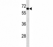 SOX9 antibody western blot analysis in HepG2 lysate. Predicted molecular weight: 56-65 kDa.