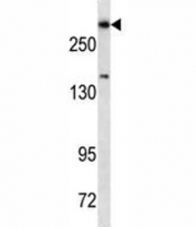 Dicer antibody western blot analysis in HepG2 lysate