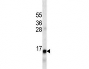 Insulin antibody western blot analysis in human CEM cell lysate.