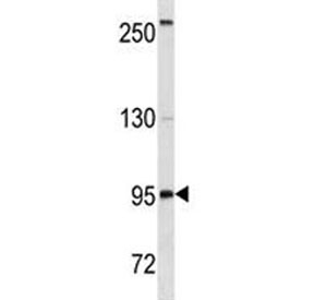 Anti-CD19 antibody western blot analysis in HepG2 lysate. Expected size: 60~100 kDa
