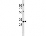 Anti-MBP antibody western blot analysis in ZR-75-1 lysate. Multiple isoforms visualized from 20~37 kDa.