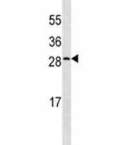 CRP antibody western blot analysis in CEM lysate