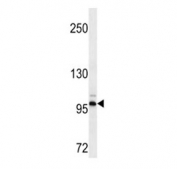 DDR2 antibody western blot analysis in HepG2 lysate. Predicted molecular weight: 97-116 kDa.