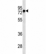BTK antibody western blot analysis in Ramos lysate