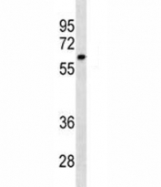 CYP1A2 antibody western blot analysis in SK-BR-3 lysate. Predicted molecular weight ~58 kDa.