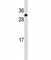 IGF2 antibody western blot analysis in A549 lysate. Predicted molecular weight: 20, 20, 26 kDa (isoforms 1-3).