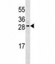 EPO antibody western blot analysis in CEM lysate. Predicted molecular weight: 18-34 kDa depending on glycosylation level.
