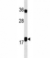 IL10 antibody western blot analysis in MDA-MB231 lysate. Predicted molecular weight ~20 kDa.