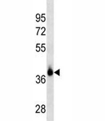EPCAM antibody western blot analysis in MCF-7 lysate