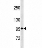 CD30 antibody western blot analysis in K562 lysate. Predicted molecular weight: 53-120 kDa depending on glycosylation level.