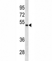 FOXA1 antibody western blot analysis in HeLa lysate. Predicted molecular weight: ~49 kDa.
