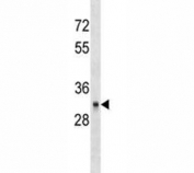 CD40 antibody western blot analysis in HL-60 lysate. Predicted molecular weight is 30-45 kDa depending on glycosylation level