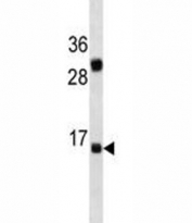 IL-2 antibody western blot analysis in K562 lysate. Predicted molecular weight ~17 kDa