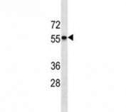 CCR7 antibody western blot analysis in HL-60 lysate. Predicted size ~45 kDa