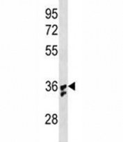 IL-1B antibody 293 cell lysate transiently transfected with the IL1B gene. Predicted molecular weight: 31 kDa (precursor) and 17 kDa (mature).