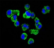 Confocal immunofluorescent analysis of CD138 antibody with U266 cells followed by Alexa Fluor 488-conjugated goat anti-rabbit lgG (green). DAPI was used as a nuclear counterstain (blue).