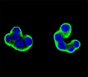 Confocal immunofluorescent analysis of CD138 antibody with T47D cells followed by secondary Ab (green). DAPI was used as a nuclear counterstain (blue).