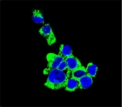Confocal immunofluorescent analysis of CD138 antibody with HepG2 cells followed by Alexa Fluor 488-conjugated goat anti-rabbit lgG (green). DAPI was used as a nuclear counterstain (blue).