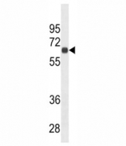 CD138 antibody western blot analysis in HepG2 lysate. Predicted molecular weight: 32-95 kDa depending on glycosylation level.