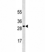 SOCS3 antibody western blot analysis in HepG2 lysate. Predicted molecular weight ~24kDa.