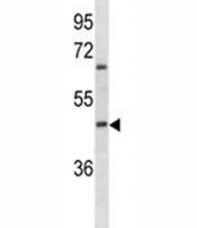 ABO antibody western blot analysis in K562 lysate