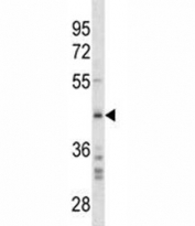 SPARC antibody western blot analysis in HeLa lysate.