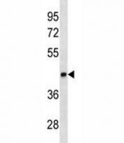 LEF1 antibody western blot analysis in K562 lysate. Predicted molecular weight ~44 kDa but commonly observed at 35-55 kDa.