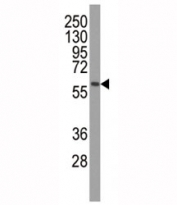 Western blot analysis of PINK1 antibody (1:500) and mouse brain tissue lysate. Predicted molecular weight: 60-70 kDa